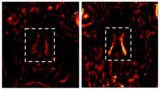 MRI of a control pig and a pig with mild traumatic brain injury