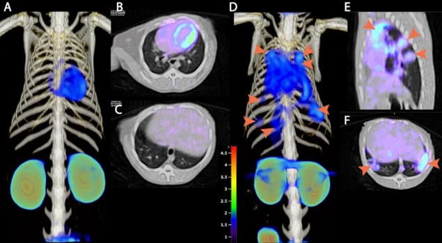 FDT-PET/CT scans of non-infected and TB-infected marmoset lungs