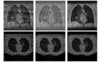 Reconstructed CBCT images