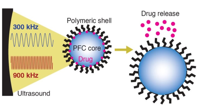 Nanocarriers release encapsulated drugs upon exposure to ultrasound