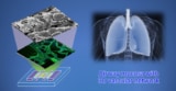 Airway mucosa