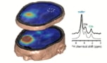 Deuterium metabolic imaging