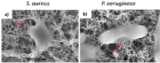 Biointerface of bacterial cells and VACNTs