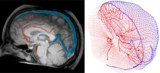 Intracranial blood flow model