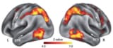 Activation (Z-score) maps