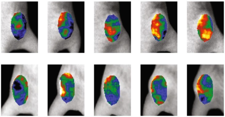 Imaging oxygenation