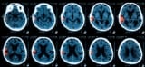 Head CT scans