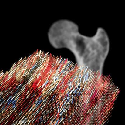 The different lamellae that make up the bone samples studied