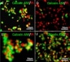 The effect of chemotherapy drugs on different types of stem cells