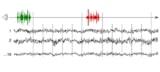 EEG traces