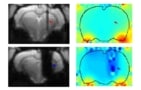 Echo-planar images from rat brains