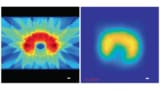 Real-time dose monitoring