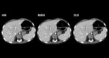 Contrast-enhanced 80 kVp CT images