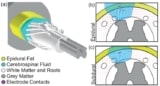 Epidural and subdural stimulating electrodes