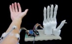 Prosthetic hand