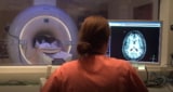 Brain MRI