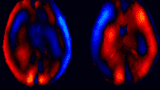 MRE brain scans