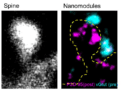 Nanomodule components in synaptic spines